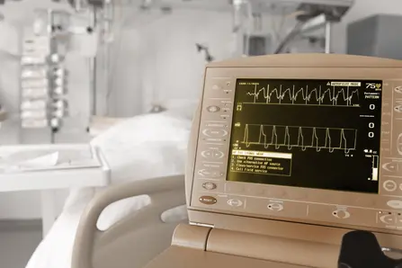 A medical monitor displays a heart rate graph with numerical data, including a heart rate of 75 beats per minute. An alert message prompts the user to check connections and call for service. In the background, a hospital bed and medical equipment are visible.